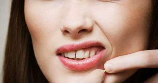 Beyaz Sivilce Belirtileri ve Tedavisi