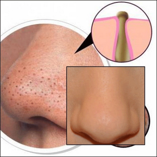 Burundaki Siyah Noktalar